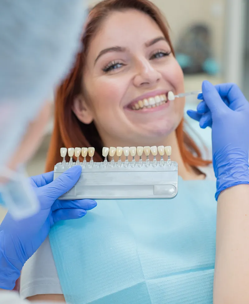 facettes dentaires balma